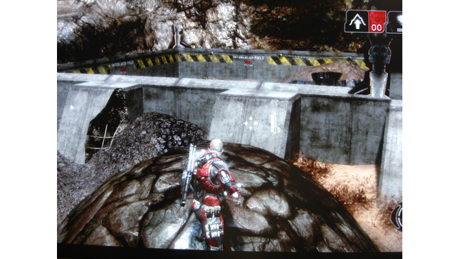 Fracture